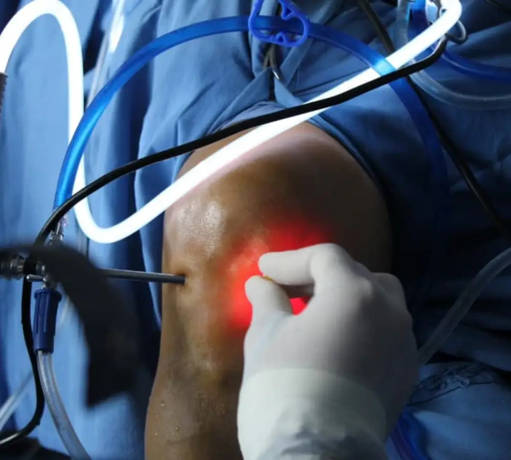 prótesis de rodillas